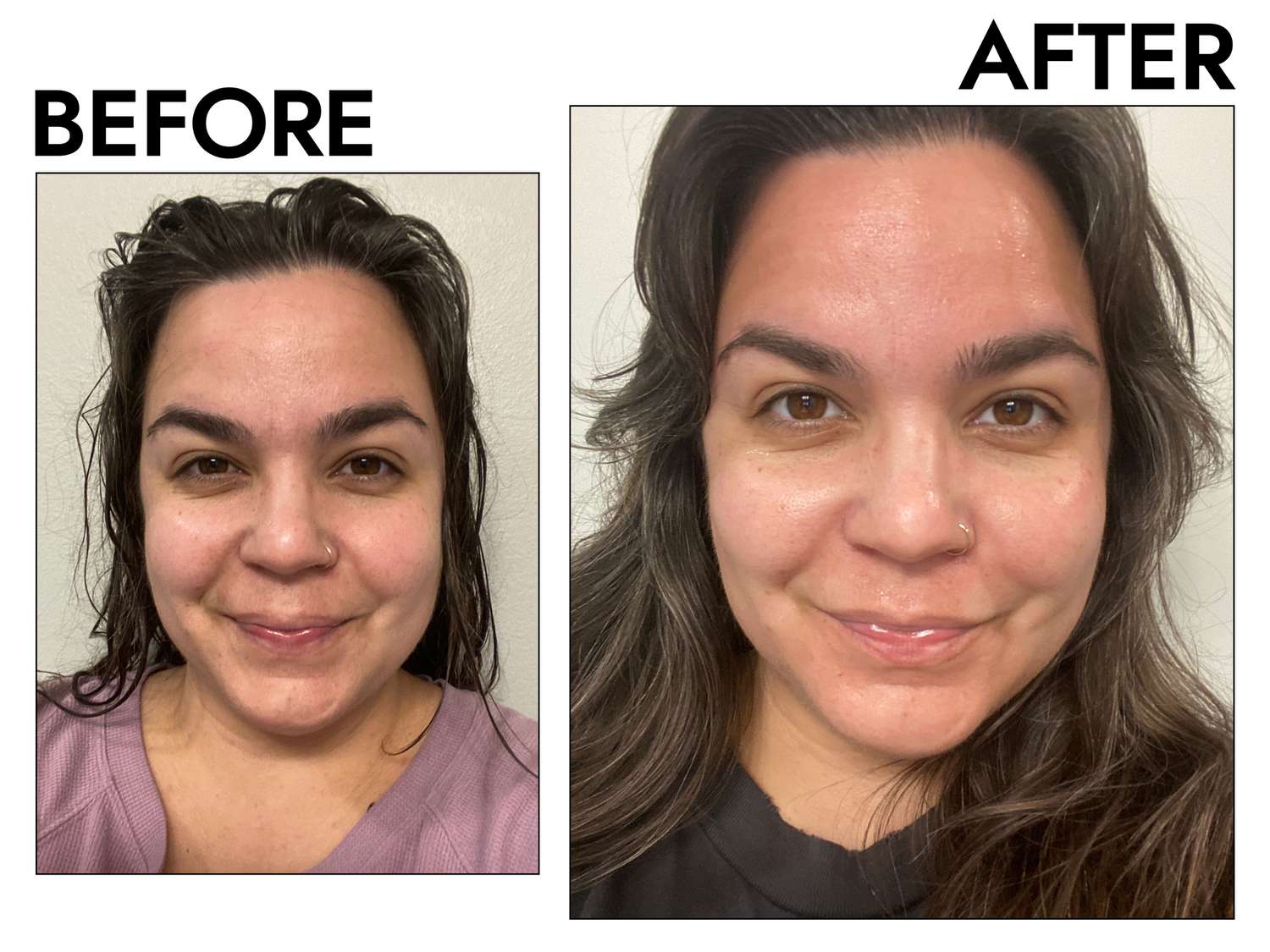 Microneedling Can Reduce Scars and Wrinkles—We Tested and Found the Best Derm Rollers to DIY the Treatment (12)