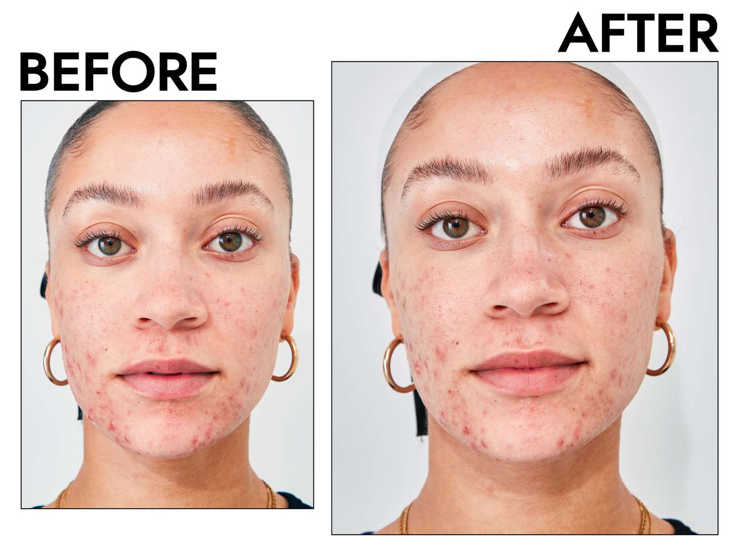 Byrdie Editor-Favorite Korean Skincare Products, Starting at Just $15 (23)